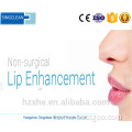 singfiller Dermal filler Lip filler injections